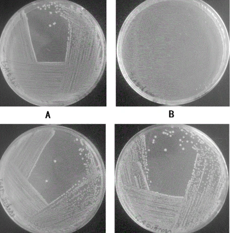 Actinobacillus pleuropneumoniae Actinobacillus pleuropneumoniae